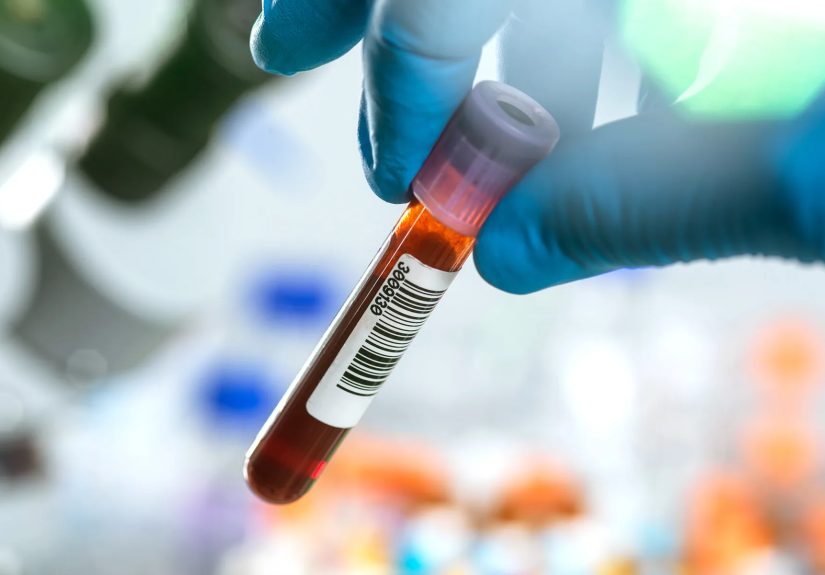 Acute Hepatic Porphyria: Why Diagnosis Is Challenging