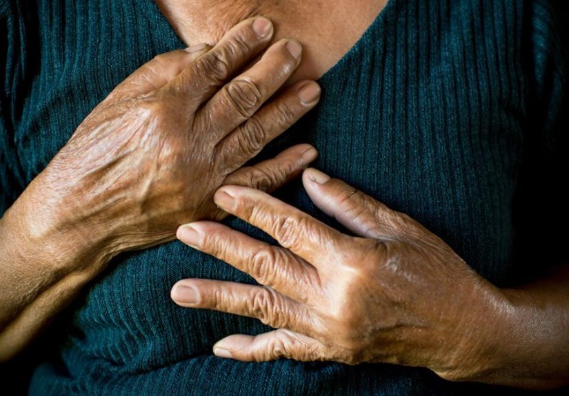 Bradyarrhythmia: Causes, Symptoms, Treatment & More