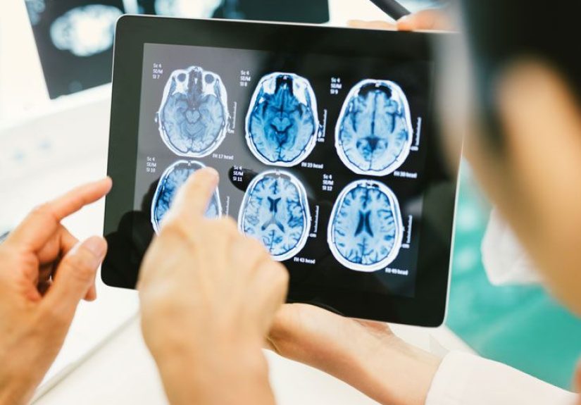 Brain Tumor: Types, Risk Factors, Symptoms, and Treatment