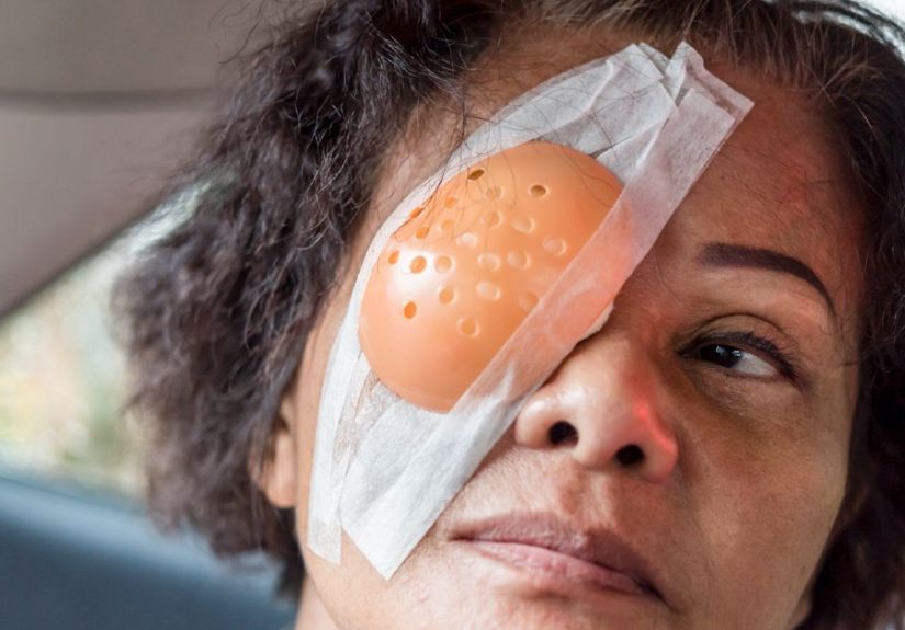 Cataract Surgery Complications: What to Know