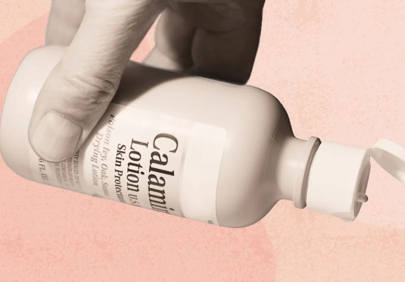 Don’t Use Calamine Lotion as a Makeup Primer, Dermatologists Warn