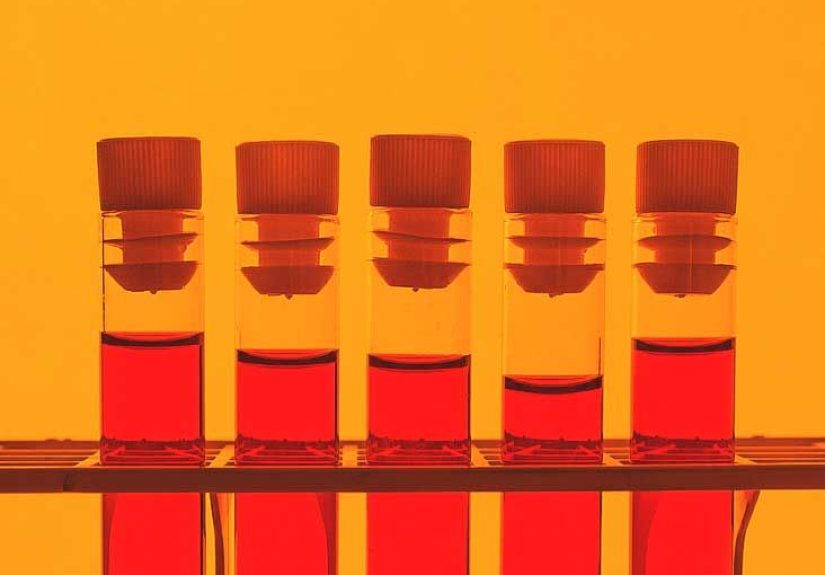 HIV Viral Load: Why This Number Matters