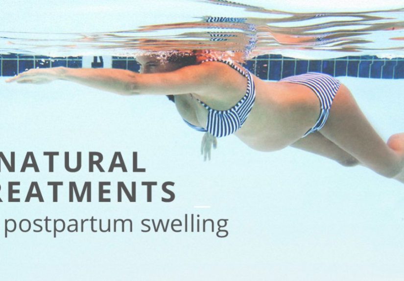 Postpartum Swelling: Natural Treatments