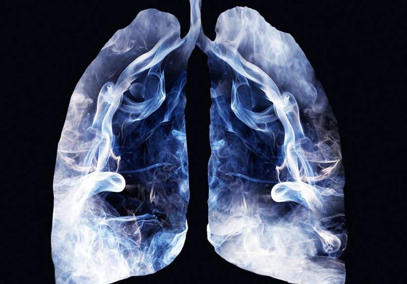 Smokers lungs: Weed, tobacco, and non-smokers