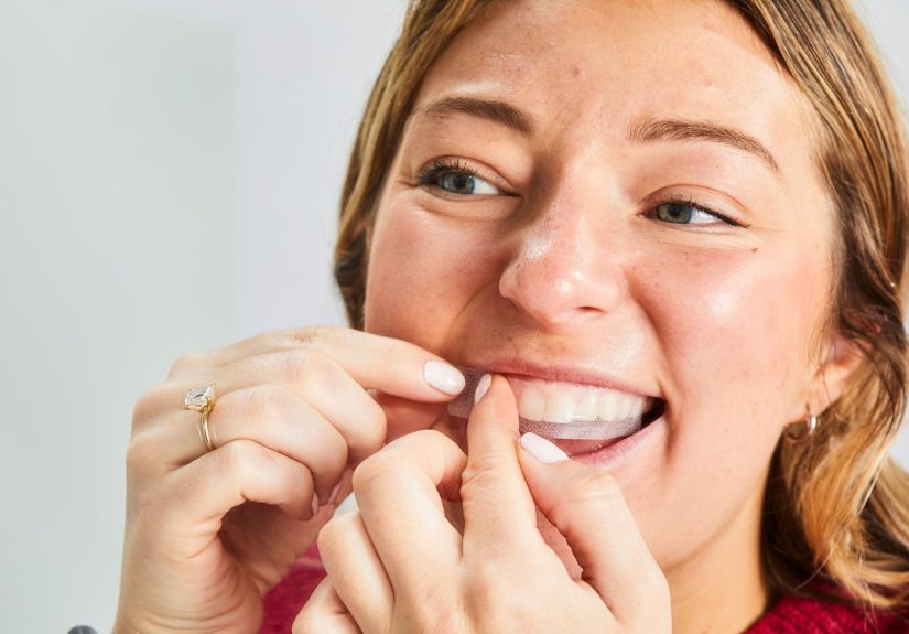 The Best Whitening Strips, According to Our Editors