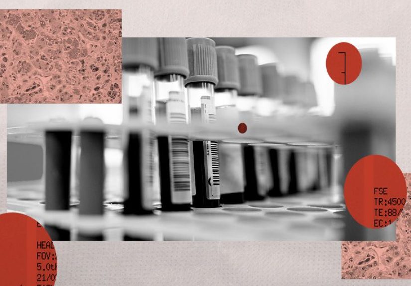 What is the difference between sickle cells and healthy RBCs?