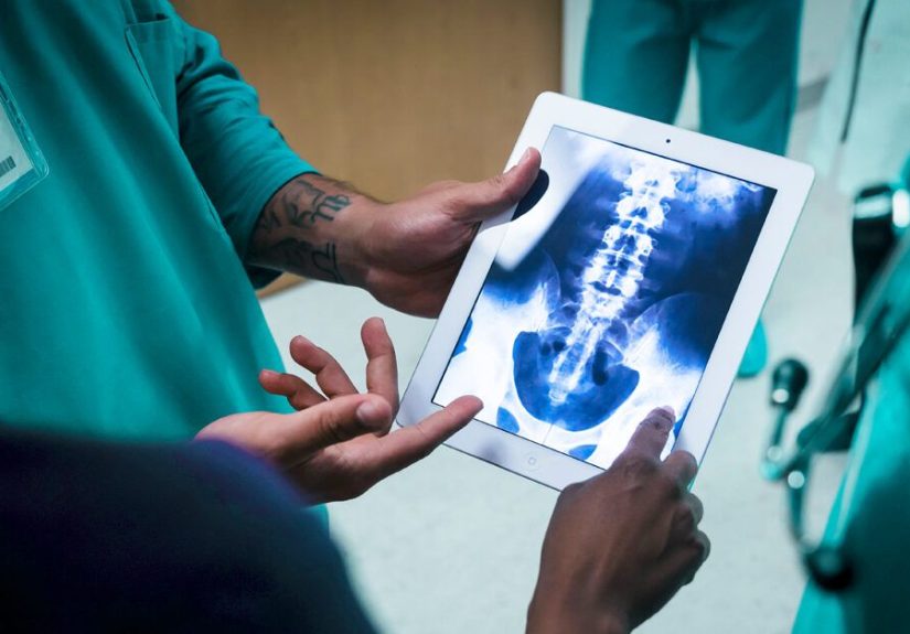 What to Expect After a Lumbar Laminectomy