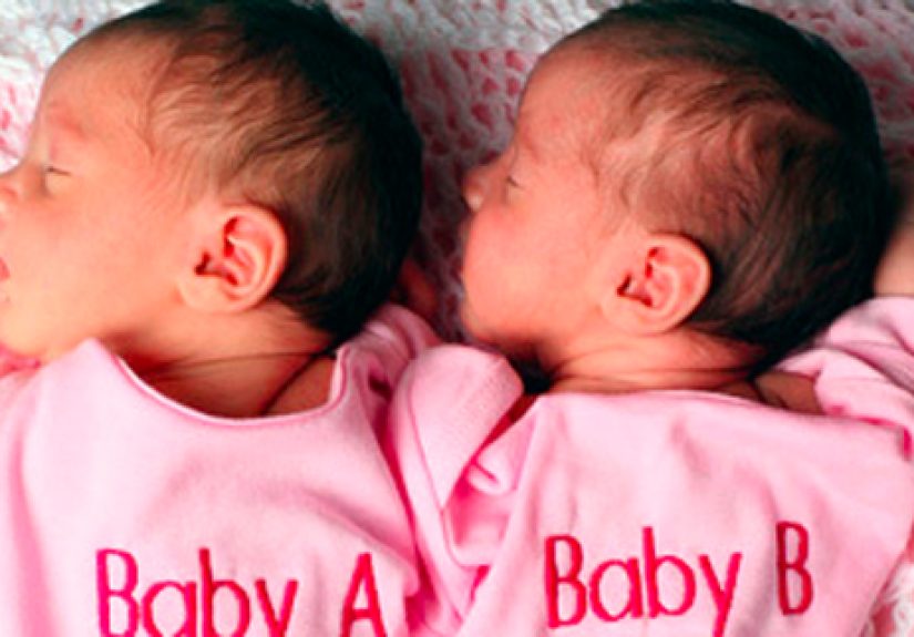 10 Incredible True Stories About Twins