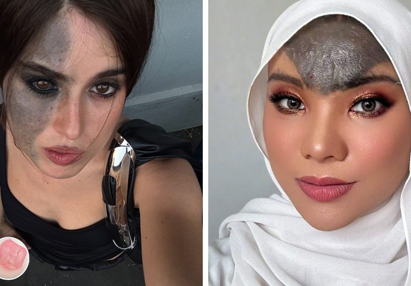 67 People Who Celebrate Their Beautiful And Unique Birthmarks
