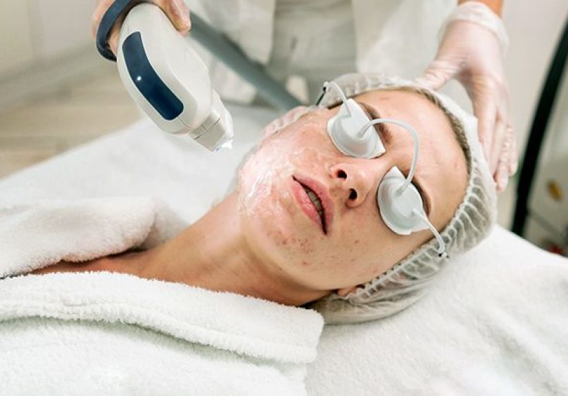 Acne Scars 101: A Complete Guide to Getting Smooth Skin Again