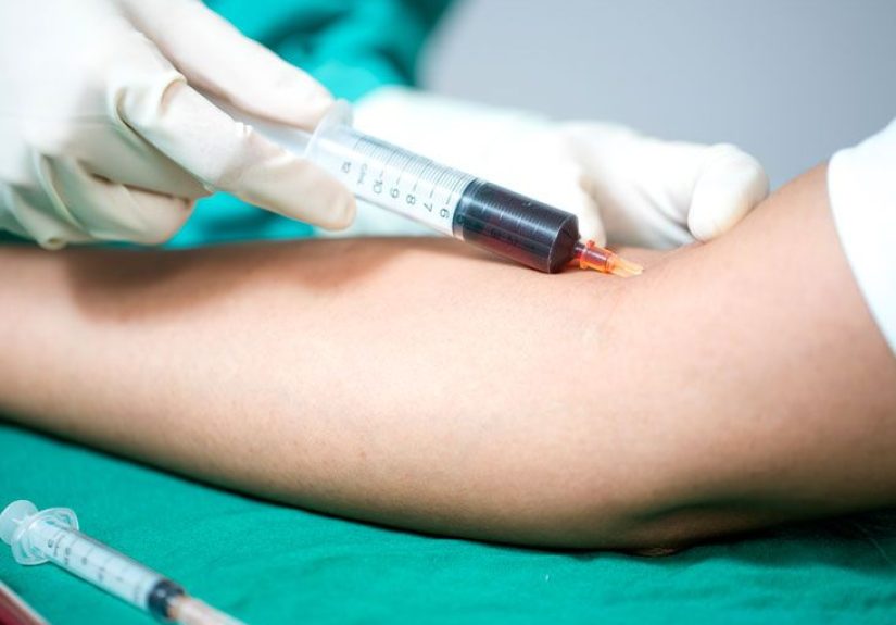 Blood Culture: Purpose, Procedure, and Risks