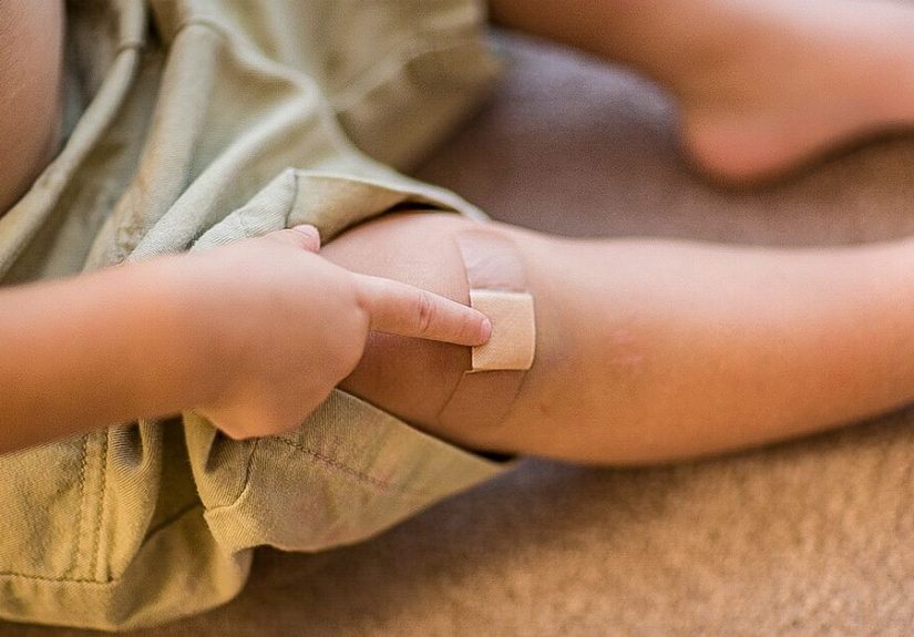 Infected Scab: Causes, Symptoms, Treatment, and Prevention