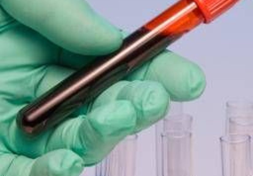 Sickle cell trait and disease: raising awareness
