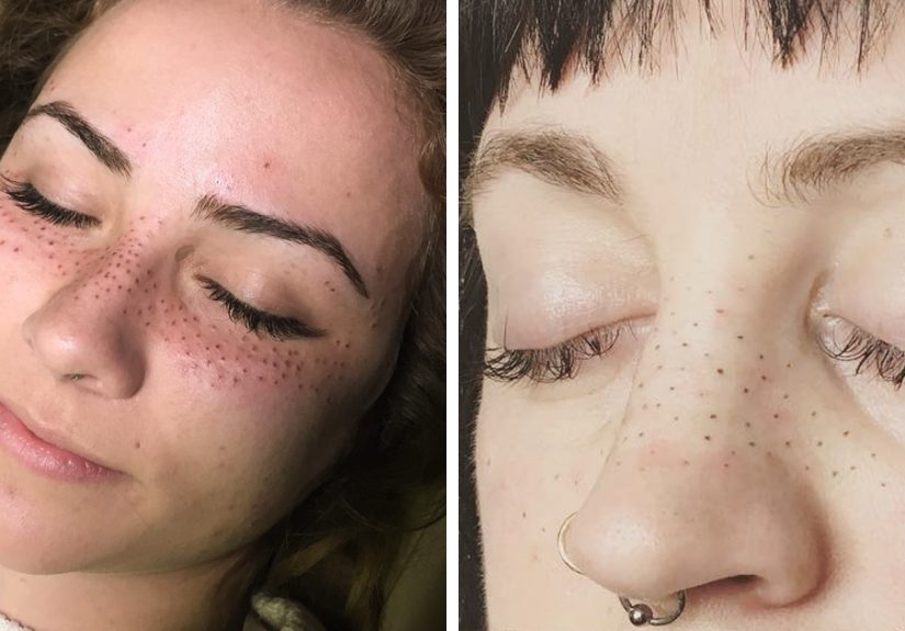 Tattooing Freckles On Your Face Is The New Beauty Craze, And They Look Surprisingly Beautiful