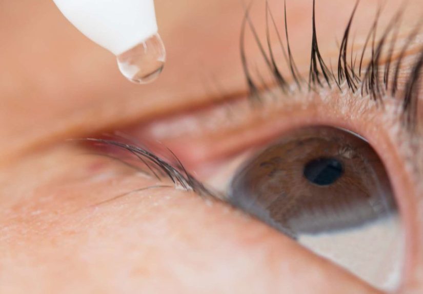Blepharitis: Treatment, Symptoms, Pictures, and Causes