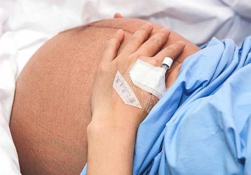 Breech Baby: Causes, Complications, and Turning