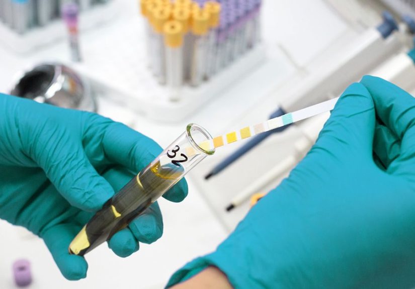 Diabetes Insipidus: Which Lab Tests Are Used to Diagnose It?