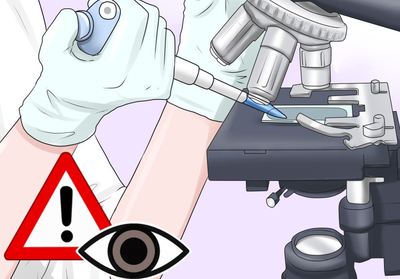 How to Calculate Anion Gap: 12 Steps