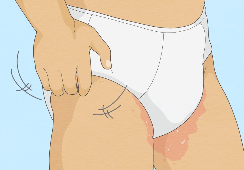 How to Get Rid of Onion-Smelling Sweat: 7 Effective Tips
