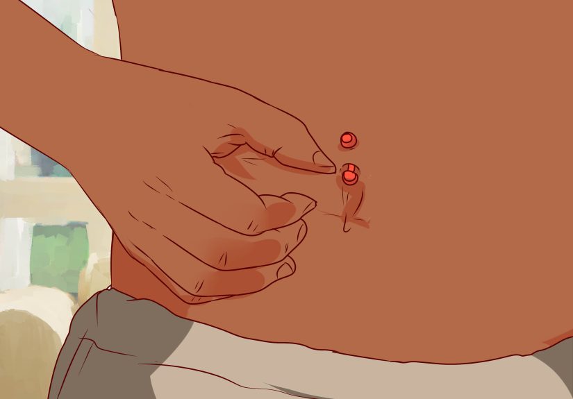 How to Pierce Your Own Belly Button at Home: Don’t  Read This First