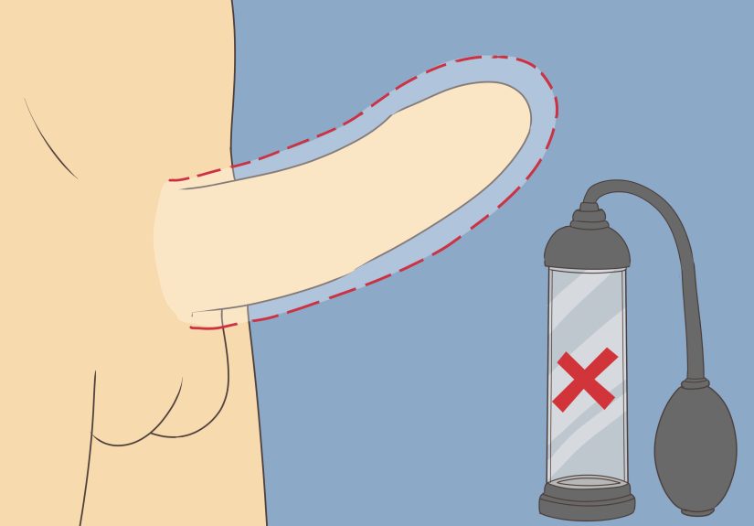 How to Use a Penis Pump