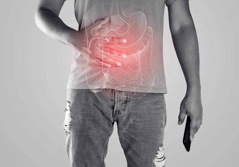When Crohn's Becomes Severe