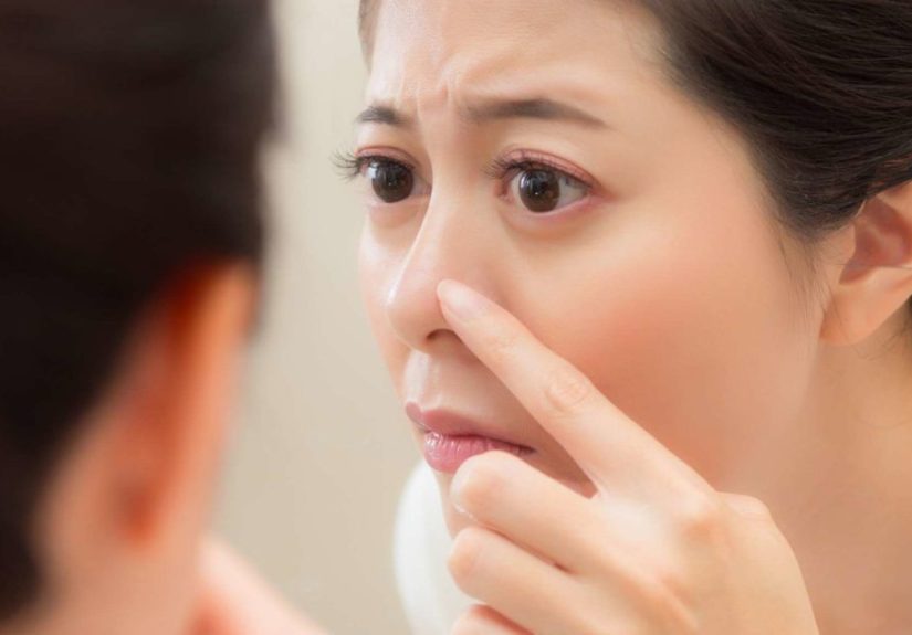 Whiteheads on the Nose: How to Get Rid of Them