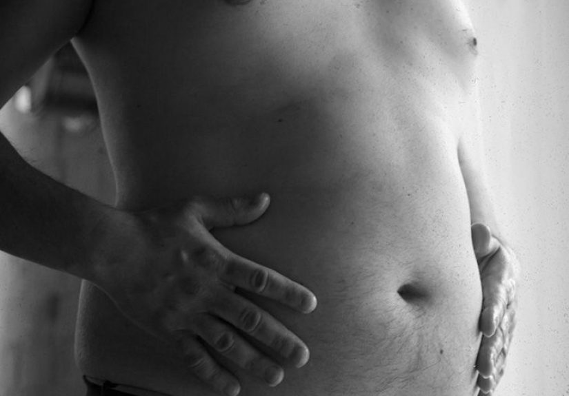 Ascites: Causes, Symptoms, and Risk Factors