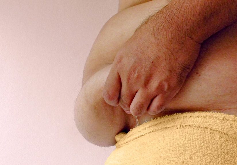 Bariatric Surgery: Types, Costs, and Results